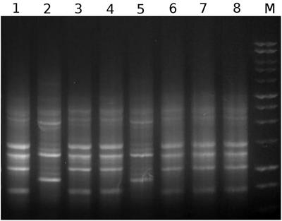 In vitro Trypanocidal Activity, Genomic Analysis of Isolates, and in vivo Transcription of Type VI Secretion System of Serratia marcescens Belonging to the Microbiota of Rhodnius prolixus Digestive Tract